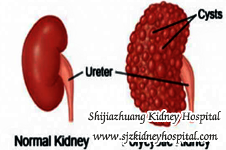 Is There Any Way To Reduce Creatinine Level Around 4 in PKD