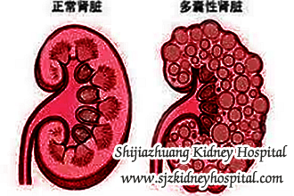 How to Eliminate Hematuria for PKD Patients by Chinese Treatment