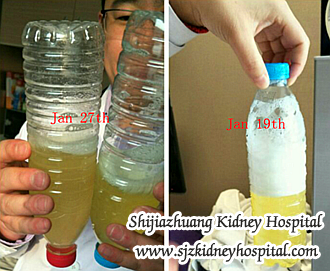 Creatinine 5.1 Should I Take Steroids To Reduce the Proteinuria