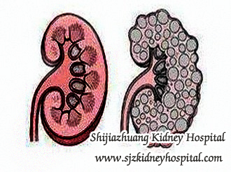 How to Preserve Renal Function Despite of Multiple Cysts in Kidneys