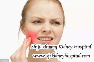 There are also some unusual infections triggering the recurrence of kidney disease