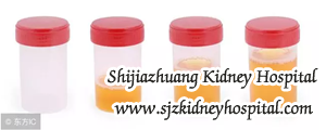 Urine protein creatinine ratio