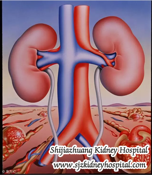  dialysis machine to help the body detoxify or doing renal transplanation