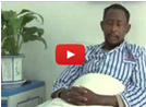 Osman, ESRD on Dialysis, Somalia